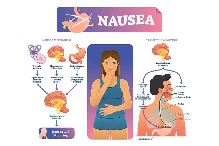 Nausea: Causes and Treatments