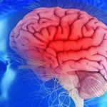 Understanding Dystonia: A Comprehensive Guide