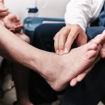 Understanding Peripheral Neuropathy