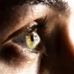 What Is Keratoconus?