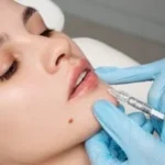 The ultimate guide to lip pigmentation removal
