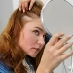 Start your hair regrowth journey today